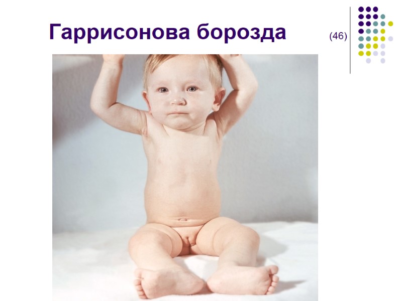 Гаррисонова борозда       (46)